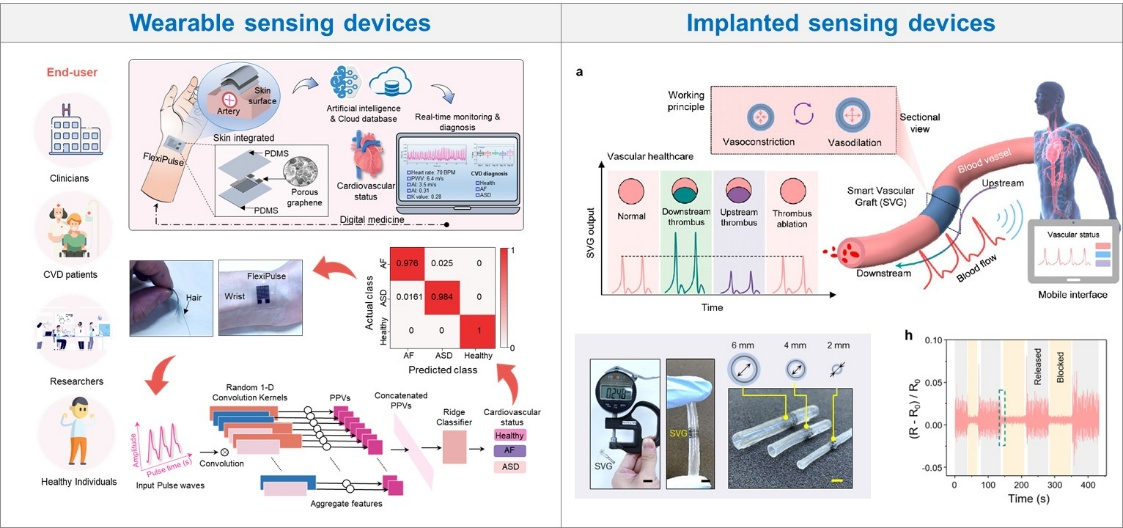 3. Bio-integrated flexible flow sensors for intelligent healthcare